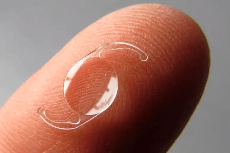 Qual a melhor lente intraocular para cirurgia de catarata? Entenda os tipos e suas diferenças